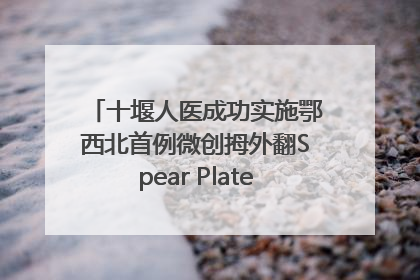 十堰人医成功实施鄂西北首例微创拇外翻Spear Plate髓内板矫形术